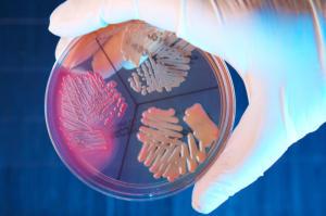 細菌正在一個培養皿裏生長。