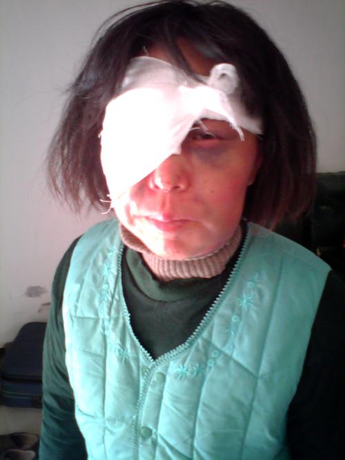 2013年4月6日，王平被国保大队队长沈士军殴打，不停用脚踢头面部，她一站起来，就被踢倒，头发也被扯下一大绺。后经医院检查，眼角踢裂，缝7、8针，后脑一2、3厘米血肿。