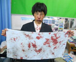 2013年6月左右，王平被城关派出所警察朱广学用拳打面部，牙齿被打掉一颗，鼻子流血不止，面部肿胀十余天不能消退。
